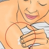 Traiter l'eczéma