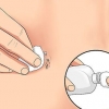 Traiter un piercing au nombril irrité
