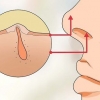 Traiter les poils du nez incarnés