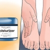 Traiter l'eczéma d'hiver