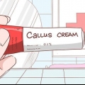 Débarrassez-vous des callosités sur vos doigts
