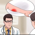 Comment traiter une déchirure musculaire du mollet