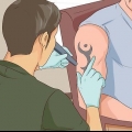 Supprimer un tatouage