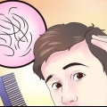 Découvrez si vous devenez chauve
