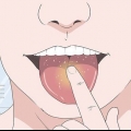 Guérissez votre langue après avoir mangé des bonbons