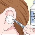 Retirer les points noirs de votre oreille