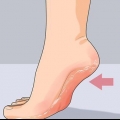 Débarrassez-vous rapidement des talons fendillés