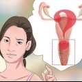 Diagnostiquer les pertes vaginales