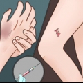 Savoir quand se faire vacciner contre le tétanos