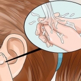 Se débarrasser des boutons dans l'oreille