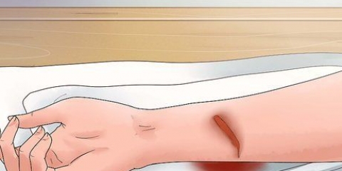Traiter une abrasion profonde