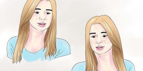 Traiter l'hyperpigmentation