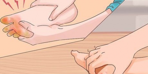 Traiter les pieds de tranchée