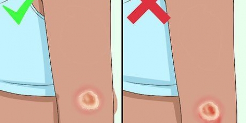Se débarrasser d'une croûte