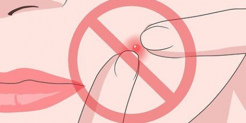 Empêcher un bouton de se développer