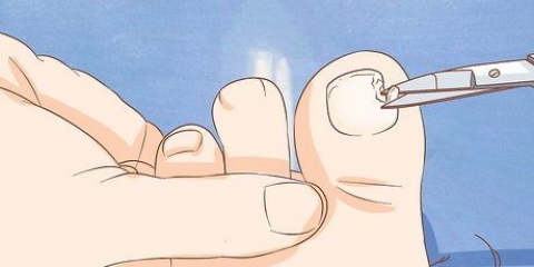 Faire repousser un ongle rapidement