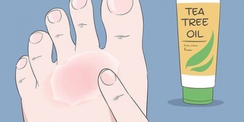 Guérir l'eczéma du nageur : peut-on le faire naturellement?